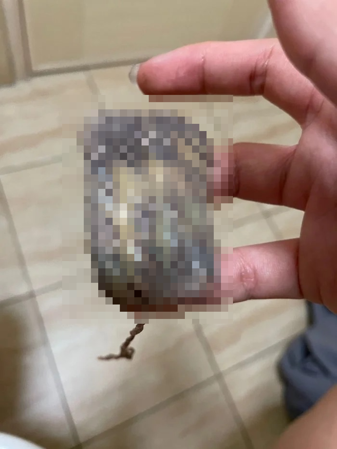 正妹因棉条放了20天忘记拿出来，而棉条呈现黑褐色让她自己也吓傻眼。（翻摄自Dcard）