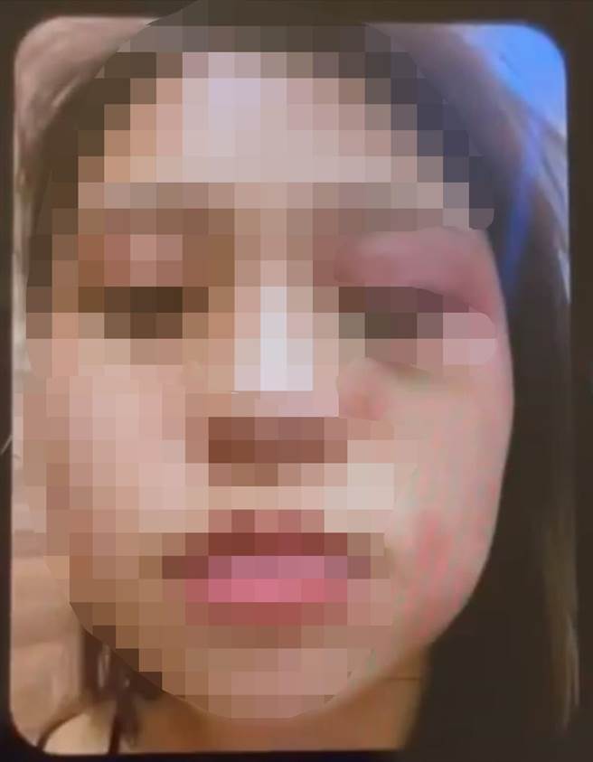 陈修将发现胡女在使用手机与别人联繫，对联络人、事交代不清，一怒之下徒手抓胡女头髮撞击地板，猛欧胡女眼部、头部等，隔天凌晨发现胡女没有生命迹象，才将胡女送医，经抢救不治死亡。（民眾提供／吴建辉彰化传真）
