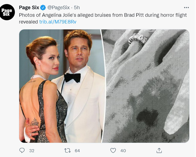 裘莉昔日向FBI提交的手伤照曝光，引发外界譁然。( Page Six 推特)