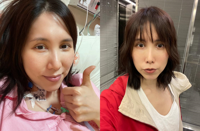 余苑绮生前为抗癌化疗将近70次。（图／余苑绮脸书）