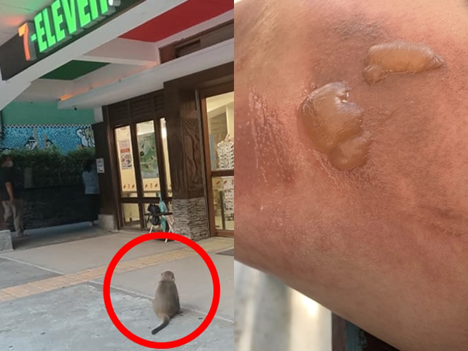 网友在中横公路天祥游憩区内的超商，准备拿泡好的泡麵出来时，突然遭到1只猴子袭击抢食，泡麵被打翻，热水直接烫伤他的腿，造成2颗大水泡。（翻摄自脸书「爆怨公社」）