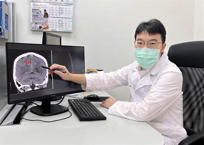 李承轩医师说明陈姓工程师影像检查发现，有脑静脉窦鼓涨及轻微硬脑膜下血肿等症状。（新竹台大生医医院提供／罗浚滨新竹传真）