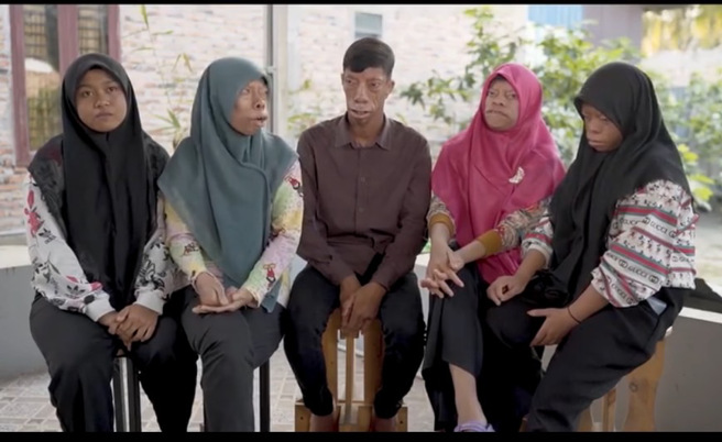 5兄妹僅1人正常，其他4人都長得像「河馬」。（圖／翻攝自IG @BornDifferentShow）