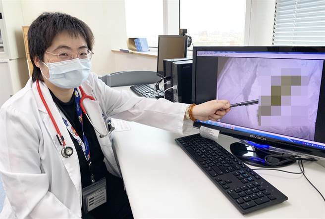 高佳慧医师笔指处，即感染沙门氏杆菌肠胃炎病童的粪便，多为黏液状糊状，也可能出现血丝便。（梧栖童综合医院提供）