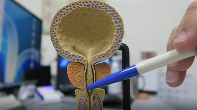 经医师检查后，发现就医的长者都是摄护腺肥大，与确诊或疫苗无关。（院方提供／吴建辉彰化传真）