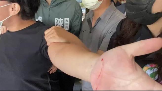 凃明诚二姐持异物割手掌，手掌渗血。（民眾提供／曹婷婷台南传真）