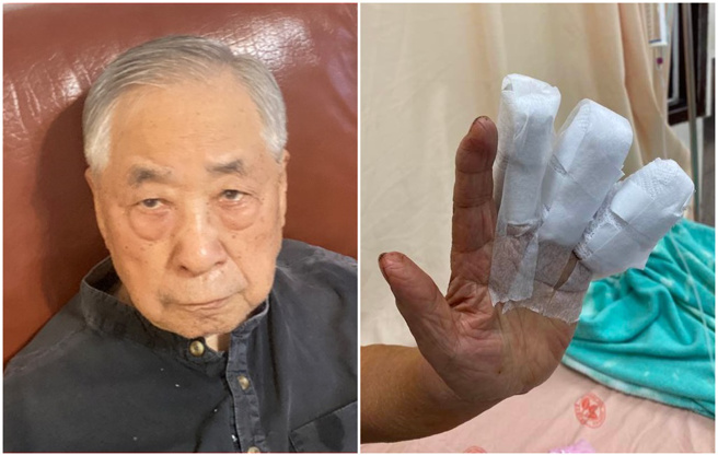 气象专家李富城最近弄伤手指。（图／FB@李富城）