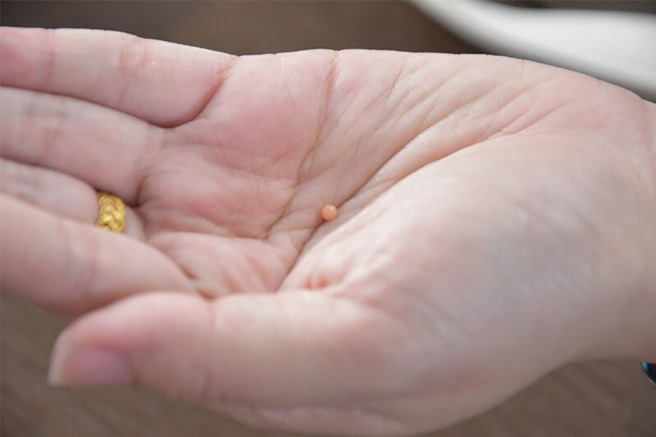 泰国一对情侣在烧烤店吃烤螺，没想到竟然咬到有珍珠之王称号的「美乐珠」，仅米粒大小就价值85万元。（图／翻摄自《泰国头条新闻》网站）