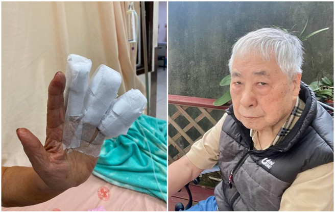 前氣象主播李富城不小心把三根手指弄傷。（圖／FB@李富城）