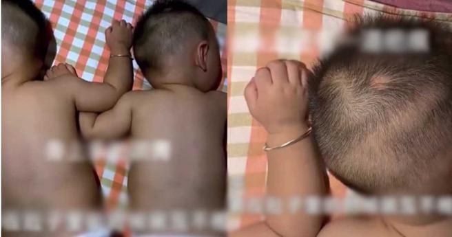 兄弟倆出生後，身上到處都是瘀青，對此2寶媽笑說，「你們長大了可別怪媽媽！」（圖／翻攝自微博／新浪熱點）