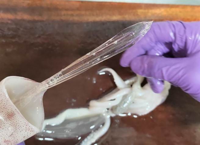 医师紧急安排手术，结果竟然在小肠内找到「透抽」体内的透明软骨，甚至次穿老翁肠道，所幸开刀后取出才捡回一命。（院方提供／吴建辉南投传真）