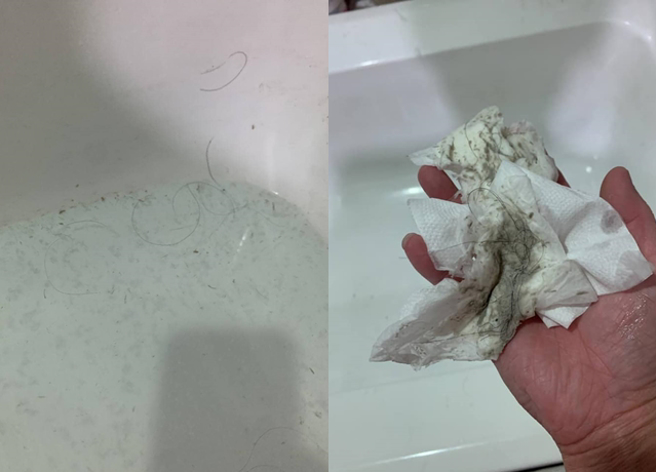 人妻拍下老公「1个月不洗澡」的结果，看到毛髮、污垢非常无奈。（翻摄自脸书匿名2公社）