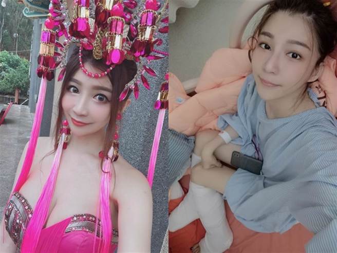 恩齊兒出海時遭大浪捲下船底，腿部遭螺旋槳吸去，小腿慘遭削去部分肉。（圖／翻攝自恩齊臉書）