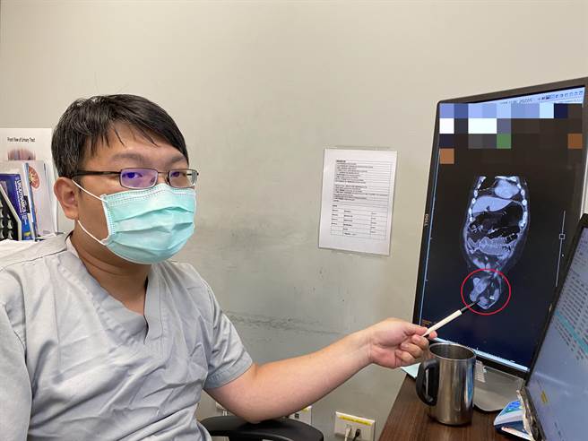 医师表示，疝气如不定时炸弹，呼吁民眾尽早就医处理。(长安医院提供／潘虹恩台中传真)