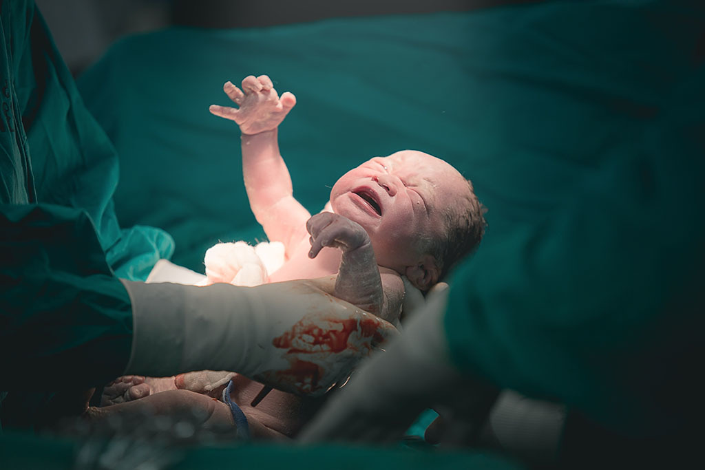 醫師表示，男嬰腹部與寄生胎連接，若不立刻處理恐造成生命危險。（示意圖／達志影像）