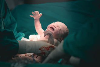 慎入！男嬰出生就擁「4手4腳2生殖器」 手術照片曝