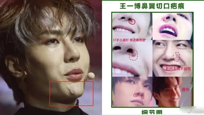 王一博被网友列出脸蛋不自然处。(图/微博)