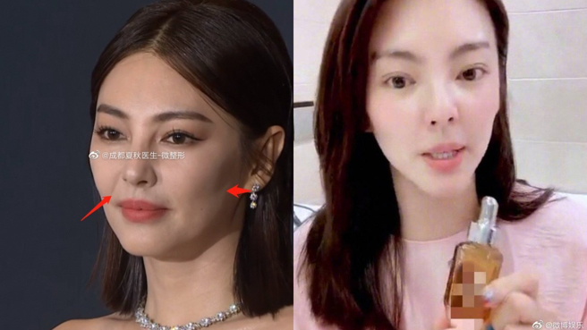张雨绮已否认整型，仍甩不开流言。(图/微博)