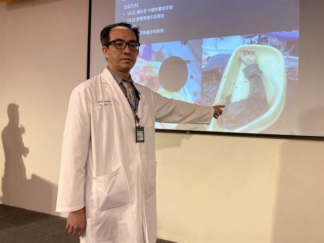 中國附醫骨科部顯微肢體重建團隊主任邱詠証指出，患者送到該院時整個左手臂被扯斷（馮惠宜攝）