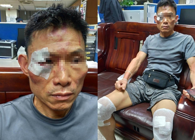 三重警误抓「特战队伍老兵」殴打缝四针 ，2警拟记过、所长2申诫。(黄敬文翻摄)