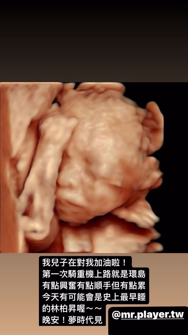 林柏升IG看见儿子超音波照握拳，让他难掩做父亲的兴奋。(图/林柏升 IG)