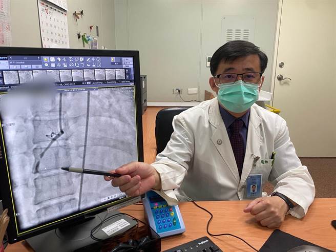 中山附医医疗部副院长詹贵川指出，31岁年轻妈妈到院时右冠状动脉已全部阻塞。(冯惠宜摄)