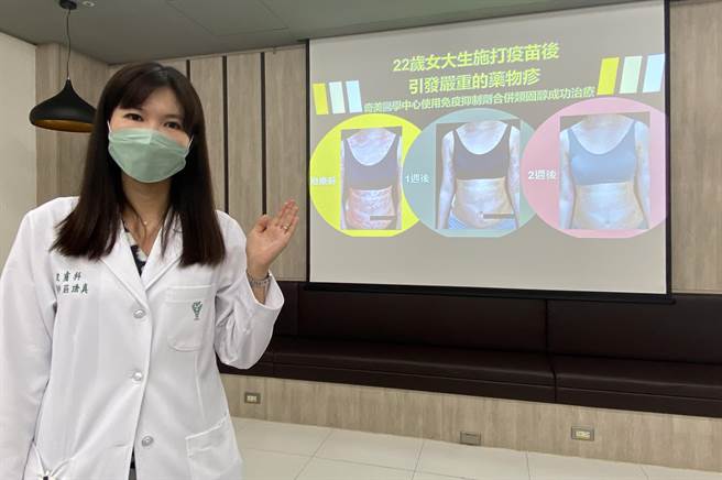 奇美医学中心皮肤科暨医学美容中心主治医师庄琇真说明女大生经治疗后，皮肤状况已经获得改善。（曹婷婷摄）