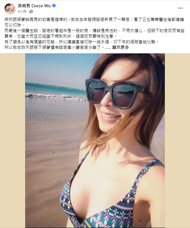 吴婉君PO比基尼照，以自身经验提醒大家要注意痣的增长和变化。（图／FB@吴婉君）