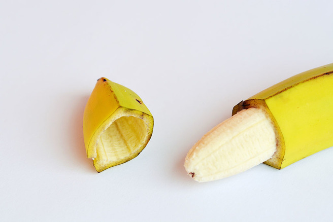 泌尿科医师指出，包皮无法推开、龟头部分露出，以及反覆感染发炎者需要割包皮。（示意图／达志影像）