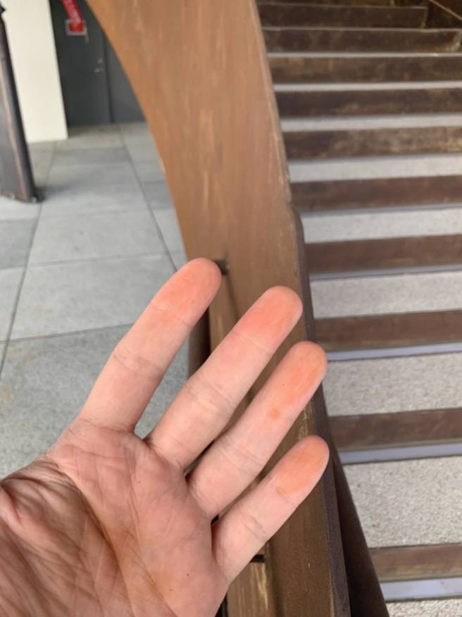 周偉航進入新竹棒球場非管制區，摸了一下樓梯隔板後沾上鏽蝕粉末，讓他忍不住開罵。（圖／翻攝特急件小周的人渣文本臉書）