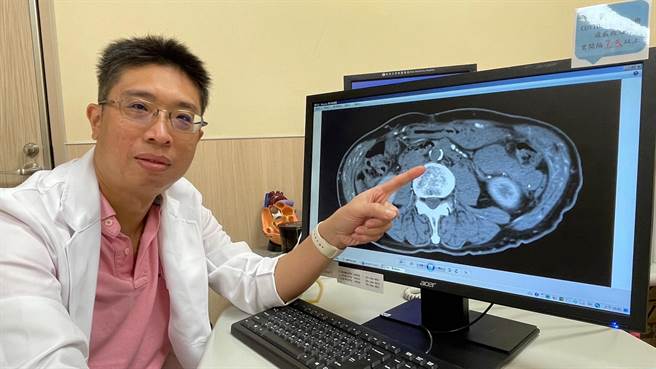 刘殷佐指出，「髂主动脉血管阻塞症候群」主要病徵会以跛行、双下肢脉搏下降、勃起困难表现，因此也俗称「脚中风」。（亚大附医提供／潘虹恩台中传真）
