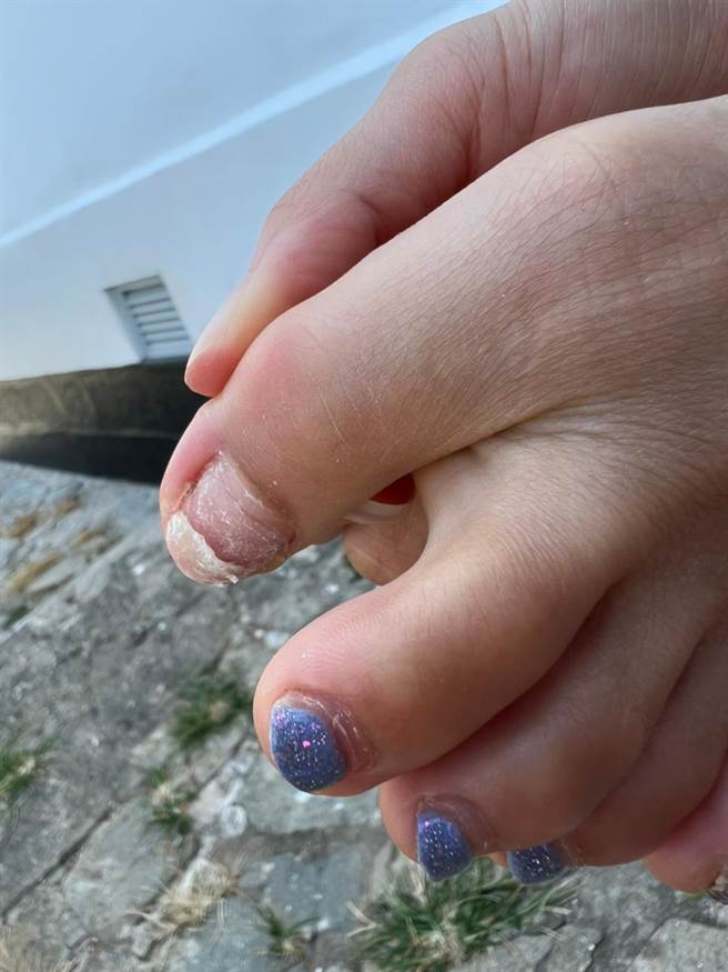 卖力的康茵茵跳舞跳到脚趾甲断裂。（维恩原创Rocky）