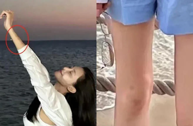 张颖颖传出手脚多了瘀青。（图／翻摄自剧综Talk微博）