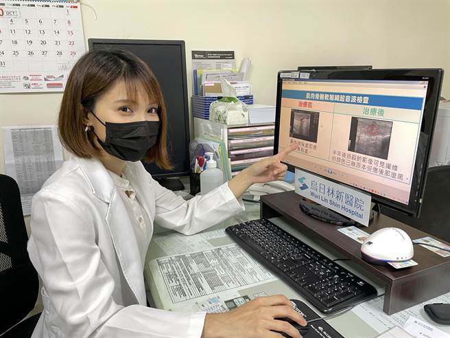 乌日林新医院復健科医师王弼慧指出，PRP高浓度血小板血浆注射属于增生疗法，可有效改善阿基里斯肌腱发炎受伤的情形，且无副作用。（乌日林新医院提供／潘虹恩台中传真）