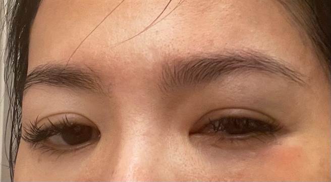 星卉曝熊猫眼伤势。（星卉提供）