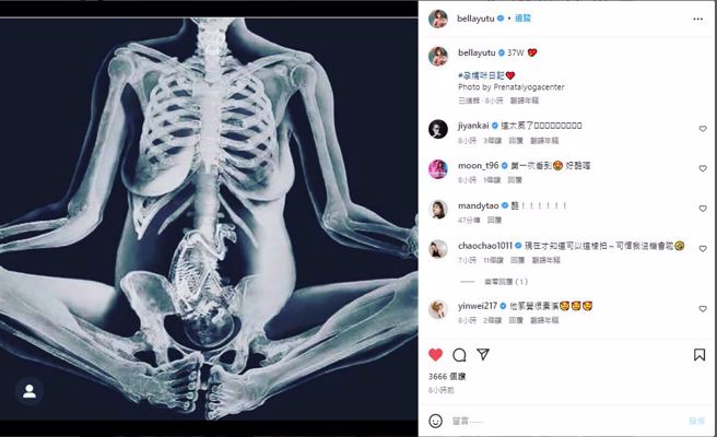 玉兔曬出孕婦照體內全透視。(圖/玉兔IG)