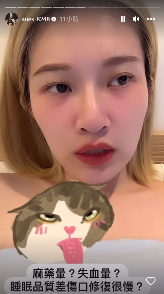 反骨艾瑞丝手术近况。(图/艾瑞丝IG)