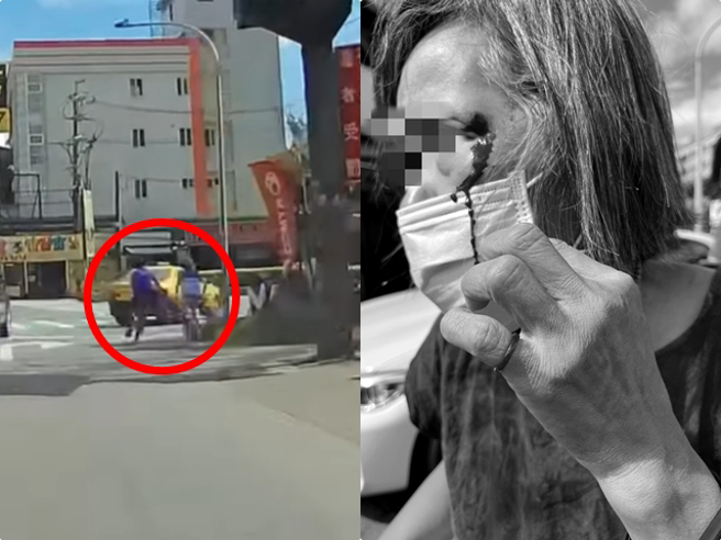 新莊1名婦人日前騎腳踏車在路上，突然遭1名陌生男子從左側猛踹車身，她當場倒地臉部挫傷，眼角冒鮮血，傷勢照與離譜影片曝光。（翻攝自臉書「爆廢公社二館」）