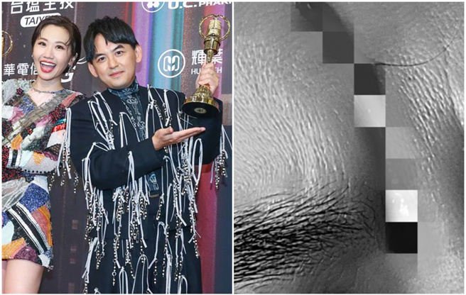 黄子佼和Lulu才夺金钟，今24日他就被艺术品砸伤头。（图／中时资料照；FB@黄子佼）