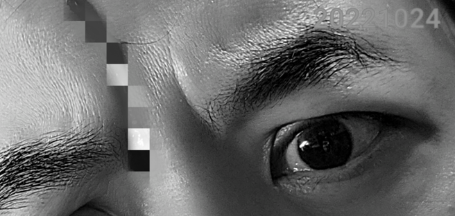 黄子佼形容自己的伤势像是拍戏场景。（图／FB@黄子佼）