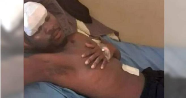 乌干达男子指控医院偷摘他的左肾。（图／翻摄自推特）