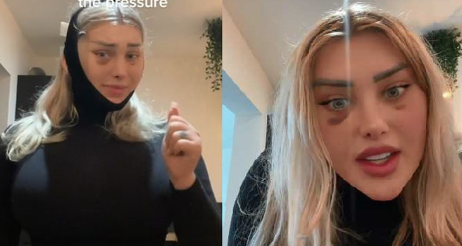 金髮模特儿做完整形手术搭飞机，头部伤口竟爆炸喷血。(翻摄自TikTok@polish_99)
