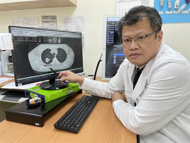 高雄市立大同医院副院长洪仁宇表示，配合国健署的计画，透过低剂量电脑断层（LDCT），可提早筛出第二期之前的肺癌患者，及早治疗、提高存活率。（高雄市立大同医院提供／袁庭尧高雄传真）