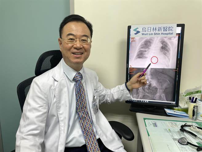 乌日林新医院胸腔内科医师许人文指出，染疫的82岁阿嬷误吞约2X1公分的金属假牙，医疗团队每一两天就安排阿嬷做腹部X光检查，避免金属假牙锐利处因移动划伤肠胃部黏膜。（林新医院提供／冯惠宜台中传真）