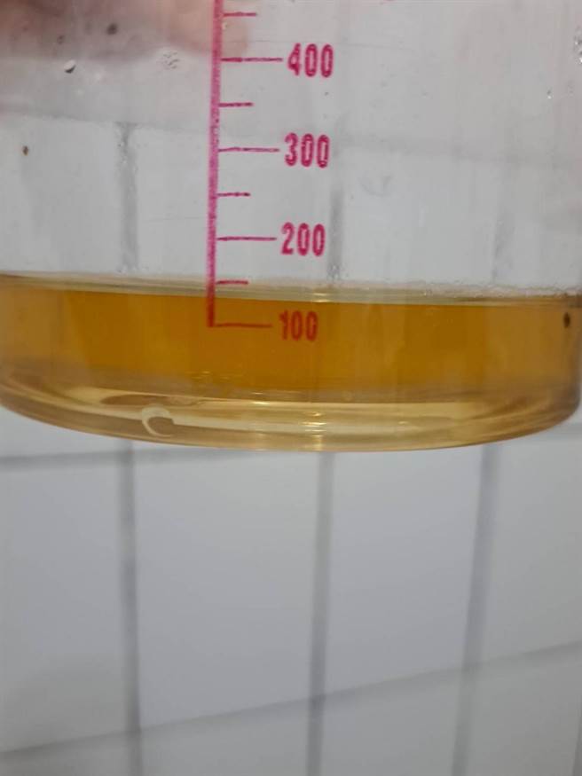 肌肉损伤导致肌球蛋白分子进入血液，再从肾臟代谢，造成小澄的尿液呈现深褐色。（台中慈济医院提供）