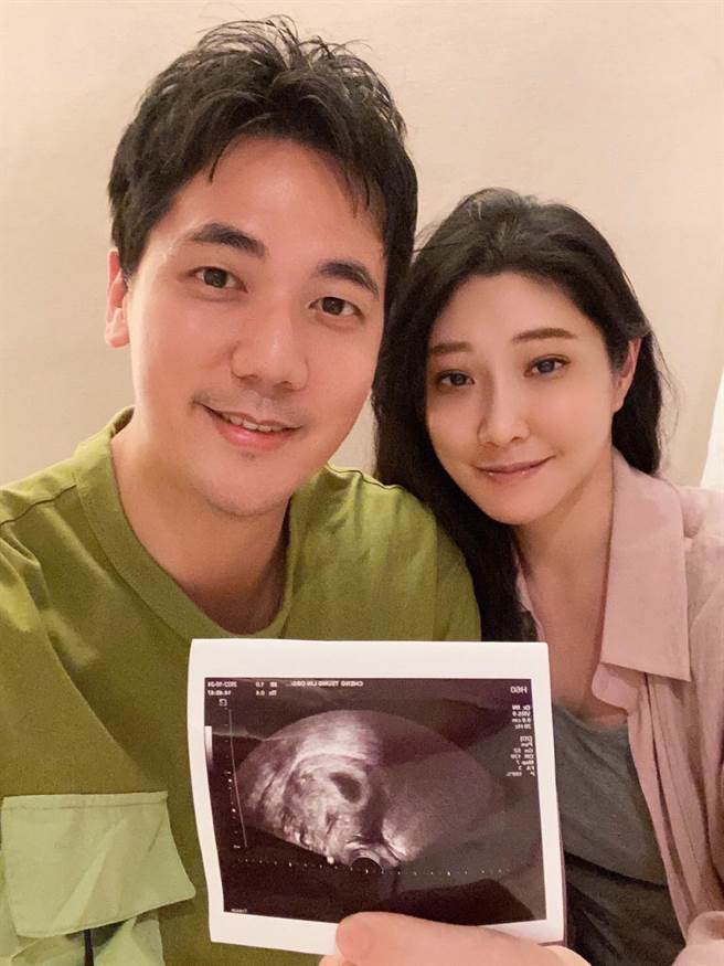 36岁的惟毅（左）与老婆开心晒超音波照片。（经纪人提供）
