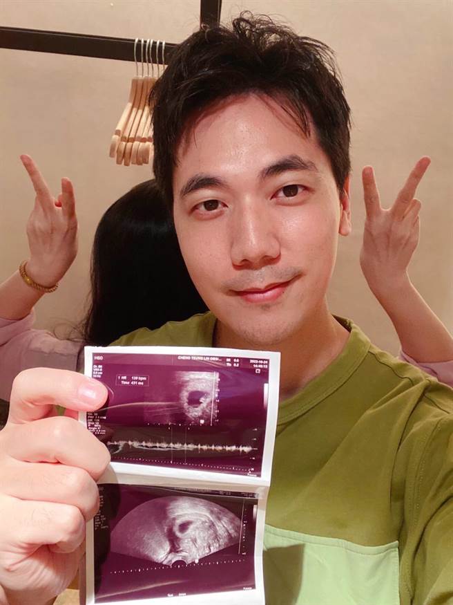 惟毅开心升格人父。（经纪人提供）