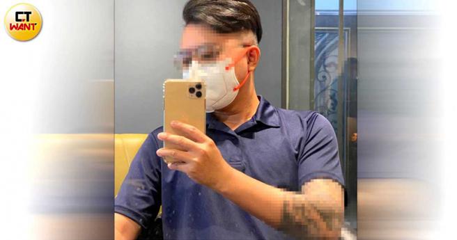 兇嫌陳柏諺畏罪輕生被救回，卻鬼話連篇，先是供稱「加工自殺」，後續又說是「意外」，他只是想「嚇嚇蔡女」。（圖／翻攝自當事人臉書）