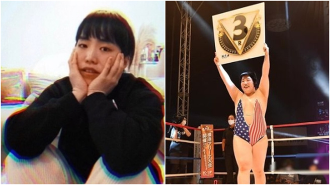 搞笑女星Yuriyan被診斷出腦損傷。（圖／翻攝自Yuriyan IG@yuriyan.retriever）