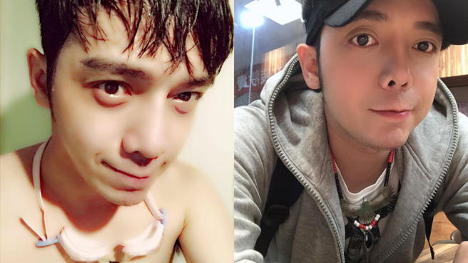 小炳自曝已签署放弃急救书和器官捐赠证明。(图/小炳 FB)